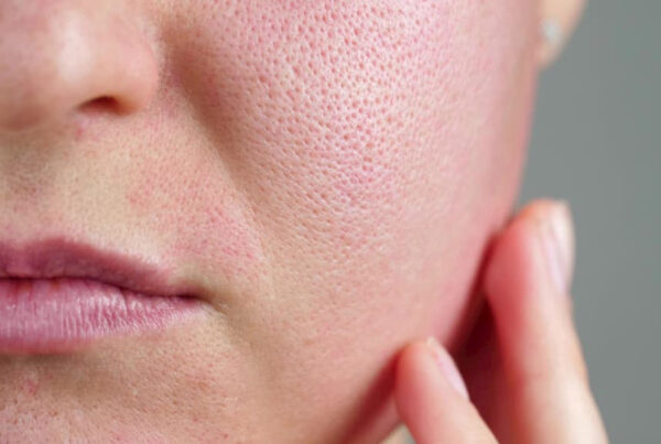 What creates pores on your skin